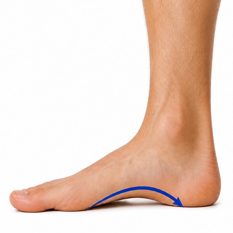 Arch Support