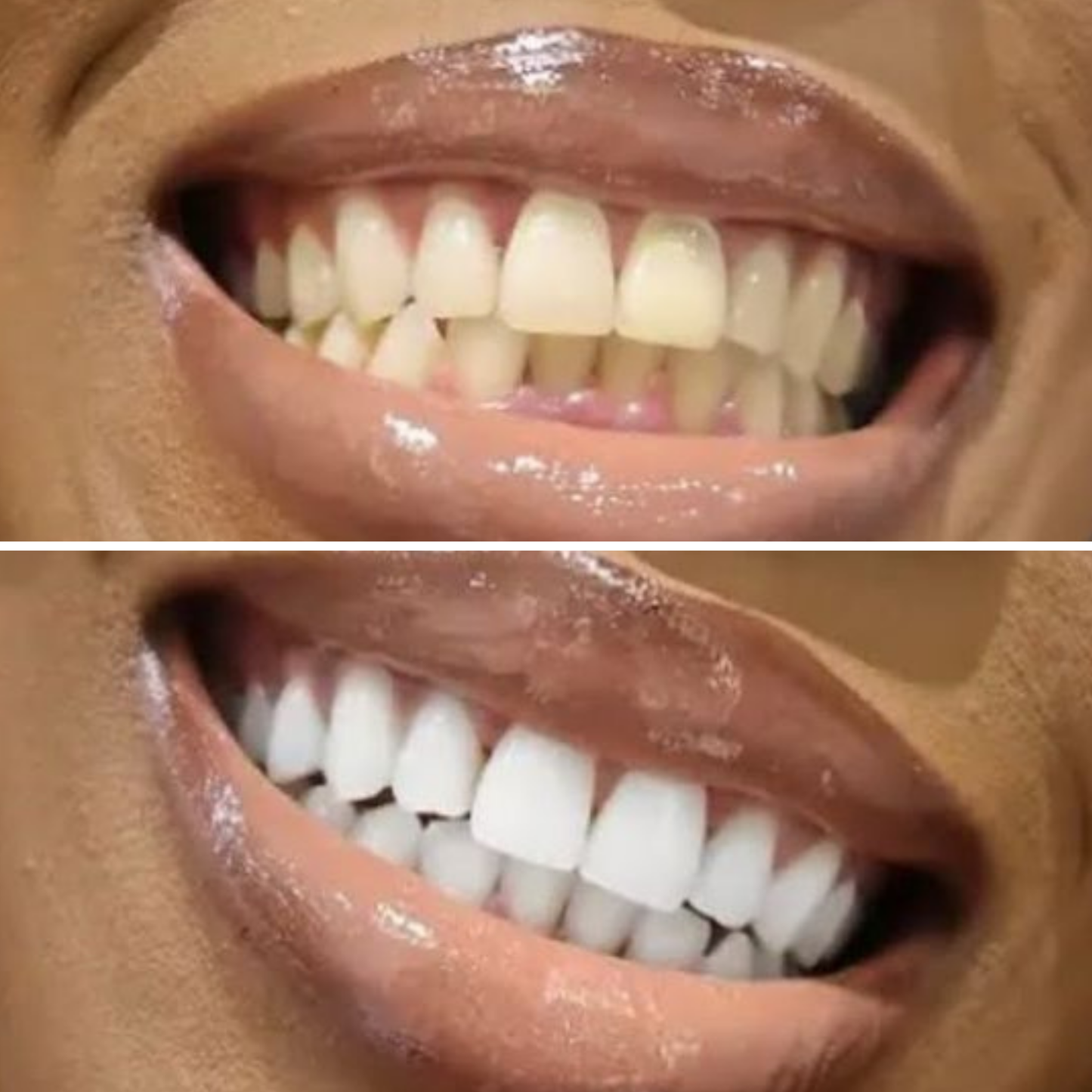 Instant-Brighten Whitening Strips™