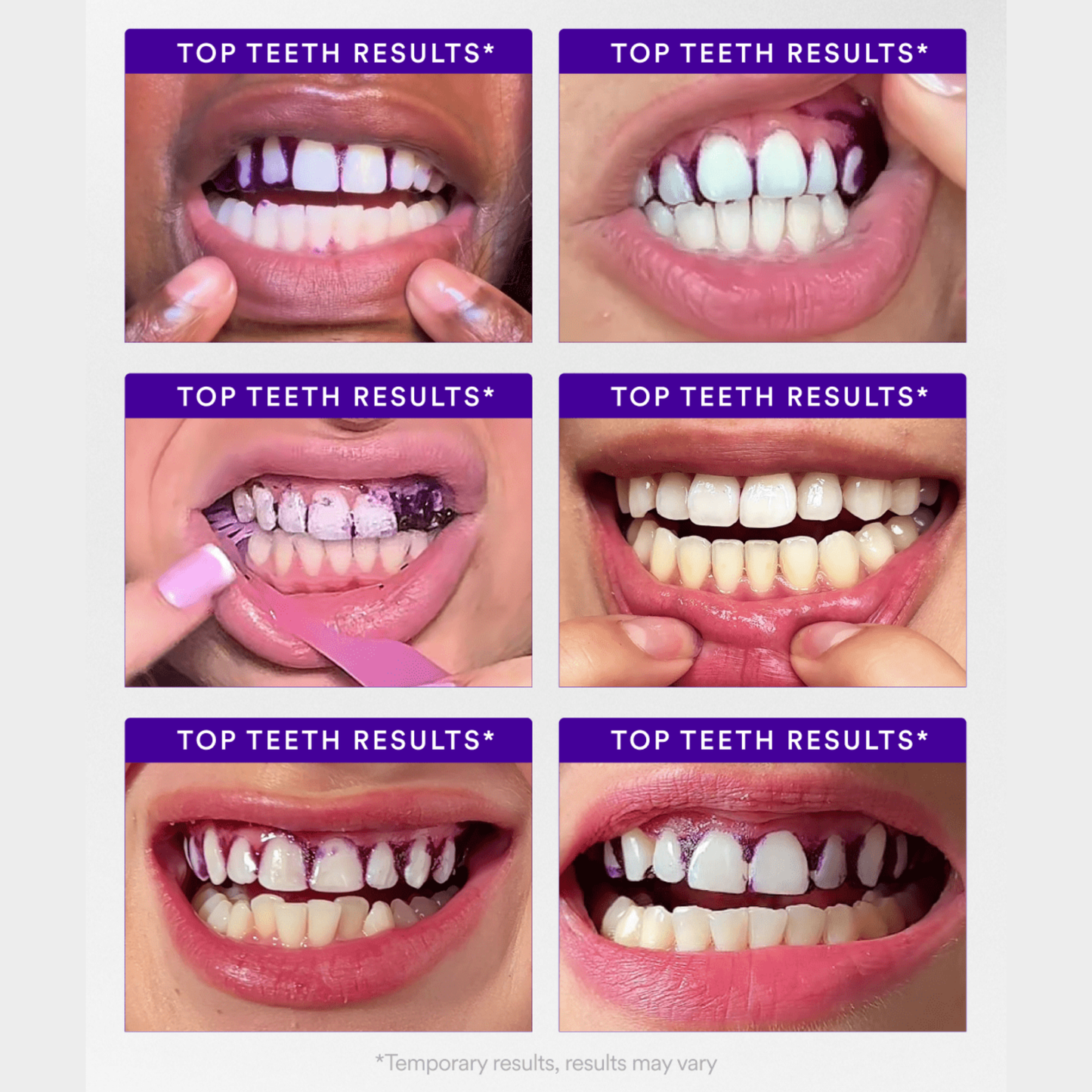 Instant-Brighten Whitening Strips