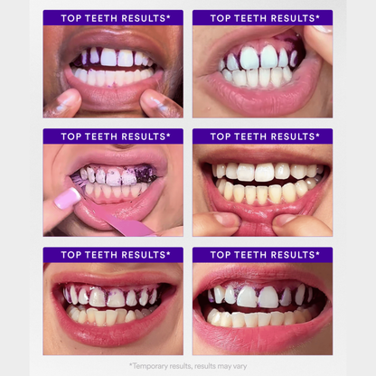 Instant-Brighten Whitening Strips