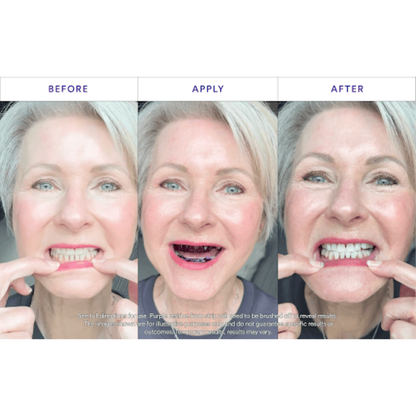 Instant-Brighten Whitening Strips
