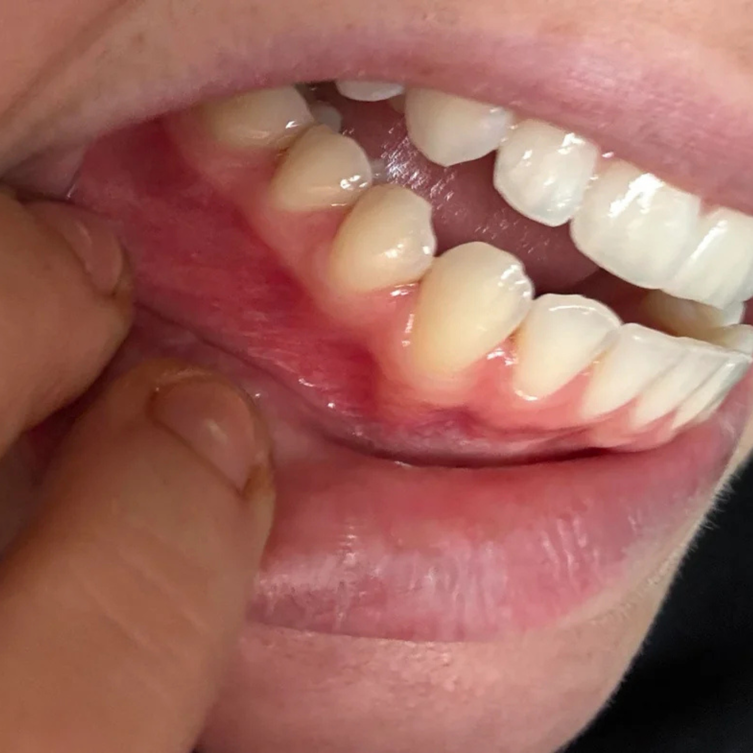 Designed For Sensitive Gums