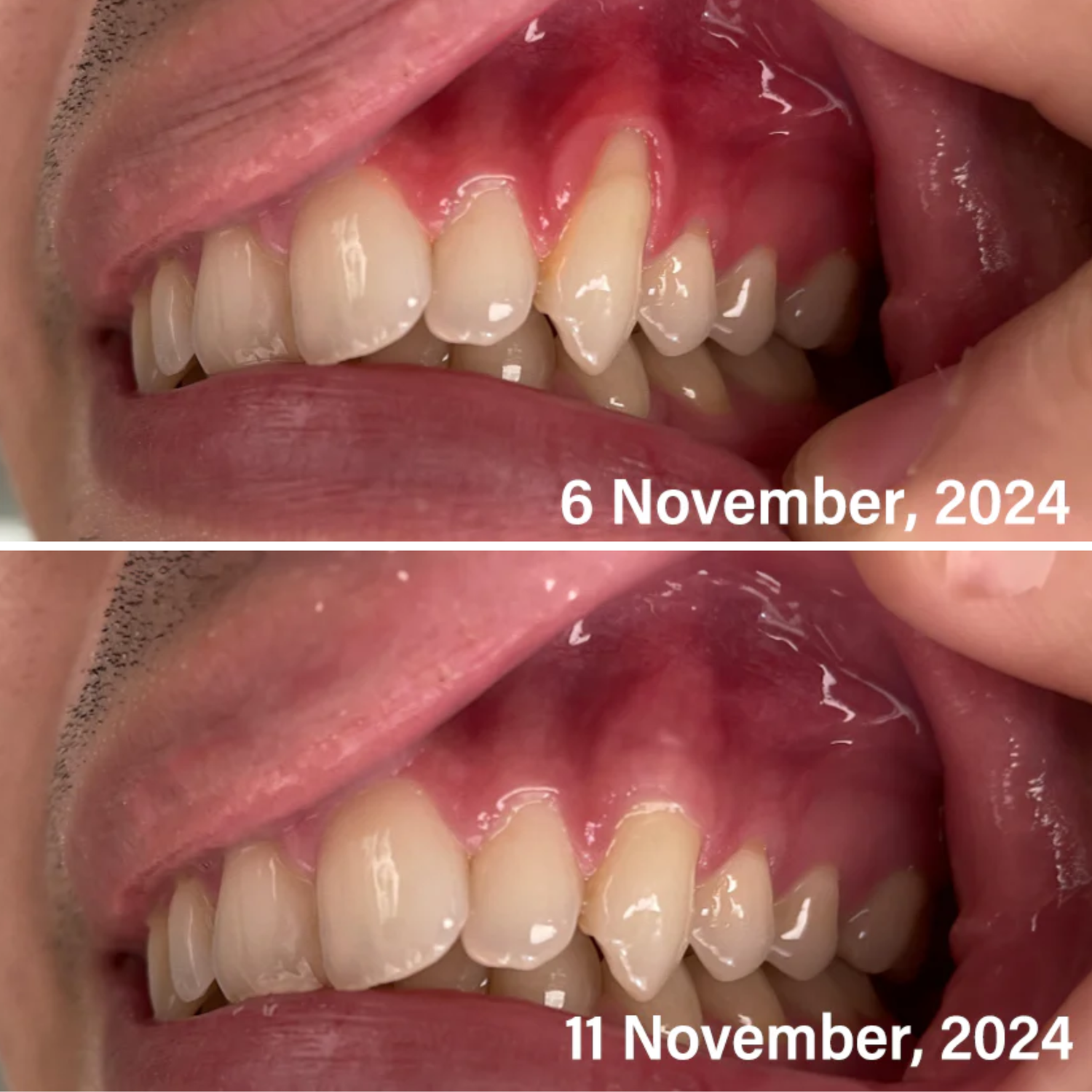Noticeable Results, Day By Day