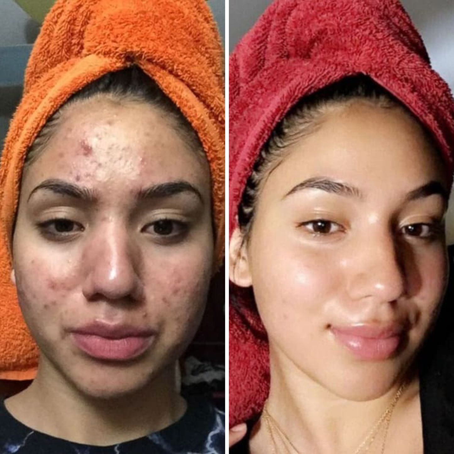 Glass Skin Premium Kit